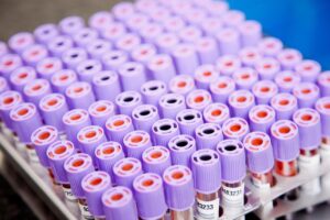 Lee más sobre el artículo BECAS INVESTIGACIÓN AAHH | Solicitud de becas de ayudas a la investigación 2025